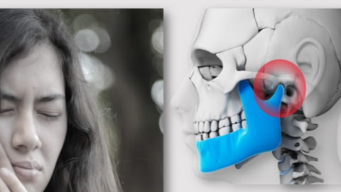 Tmj Injuries Loughborough Physiotherapy | Physiotherapy & Sports Injuries Clinic